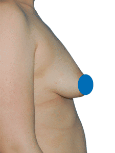 AureaClinic giphyupload beauty surgeon plastic surgery Sticker