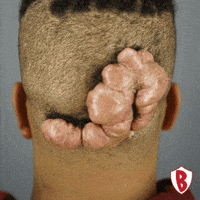 Before And After Transformation GIF by Dr. U Hair and Skin Clinic