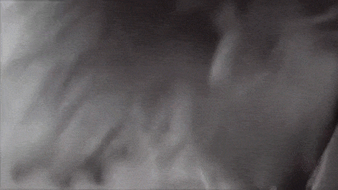 blood pain GIF by The Special Without Brett Davis