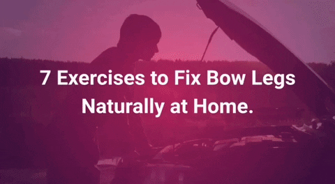 Bowlegsnomore legs bowl knock knee leg problem GIF