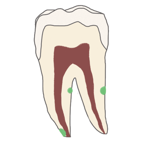 Endodoncia Sticker
