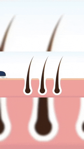 Trandup giphyupload GIF