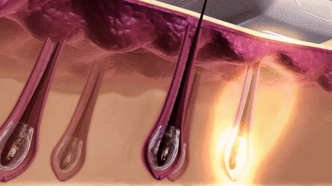 SilkySkin giphygifmaker GIF