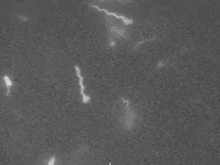 escherichia coli bacteria GIF