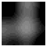 Dct Pain GIF
