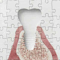 Teeth Tooth GIF by MegaGen Implant