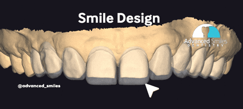 asdtj giphygifmaker giphyattribution white teeth new smile GIF