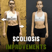 Scoliosis GIF by functionalpatterns