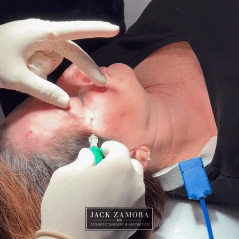 JackZamoraMD giphyupload GIF