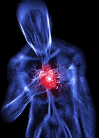 Heart Attack Xray GIF