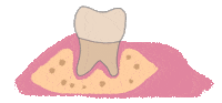 Denture Sticker