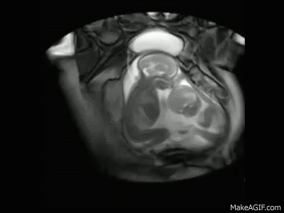 womb GIF