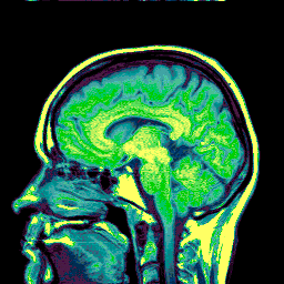 brain scan madness GIF