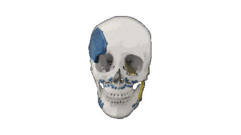 MaterialiseBrasil giphyupload logo tmj implant Sticker