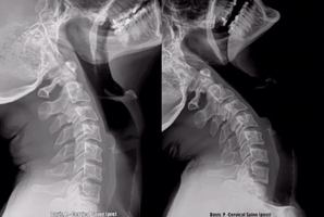 Motion xray