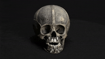 skull eruptingteeth GIF by Mütter Museum