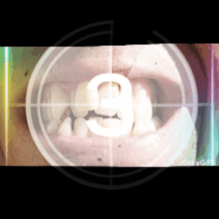 Teeth Missing GIF