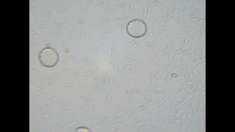 pappandreae29f giphygifmaker kovasz rózsaszín bakterium GIF
