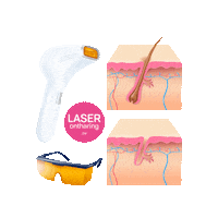 Laserontharing laserhairremoval laserontharing ontharen ontharing Sticker