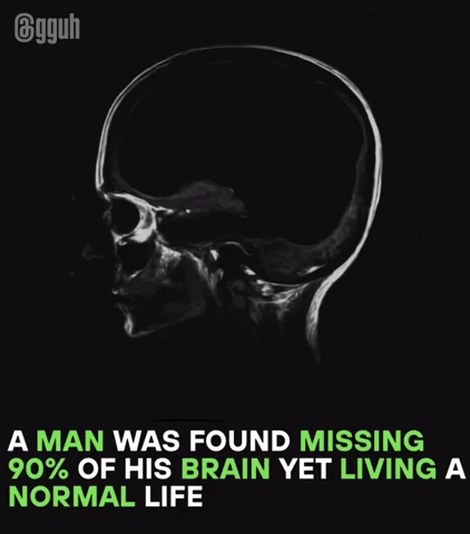 Michael_Storen brainless gguh gguh dumb GIF