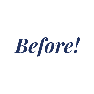 Beforeandafter Sticker by 270M