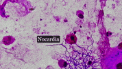 Branching Gram Positive GIF by Ansel Oommen