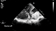 GIF by Harvard University