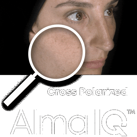 Skin Analyse Sticker by Alma Lasers GmbH