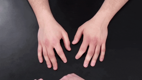 traumatologiayortopediauc giphyupload mano traumatologia examen fisico GIF