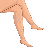 Laserhairremoval Sticker by TiamSpa