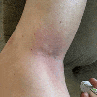 Insect Bugd GIF by Bug Bite Thing
