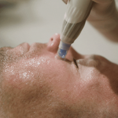 faceofman skin healing trauma mens grooming GIF