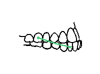 mytwofront underbite twofront two front mytwofront Sticker