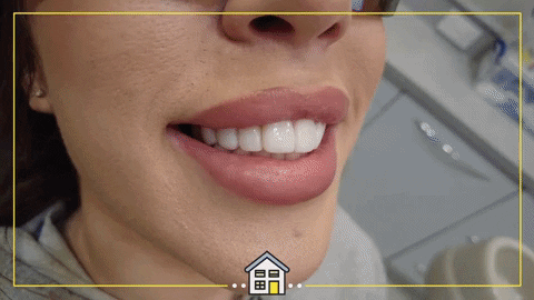 Happy Doctor GIF by The Dental House