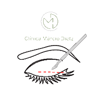 clinicamarciodietz estetica clinica lipo de papada palpebras Sticker