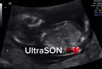 Son Ultrason GIF