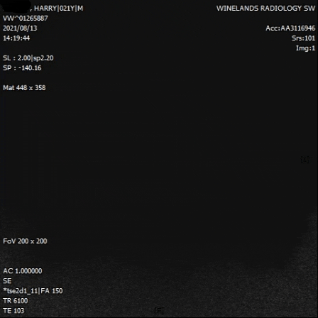 giphygifmaker turtle brain scan GIF