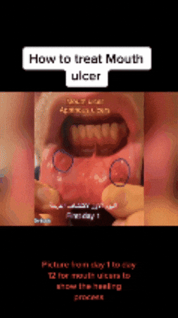 mootttt giphygifmaker GIF