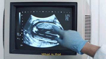 ultrasound burger king mystery GIF by ADWEEK