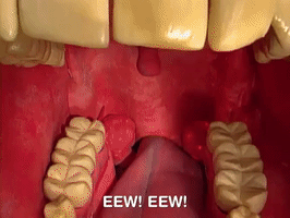 200.gif?cid=fc005b083ad98b1615a3cc2e60006d7c52b26032d92d82a7&rid=200.gif&ct=g