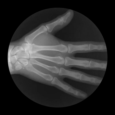 GifsdaFisio fisioterapia mao movimento anatomia GIF