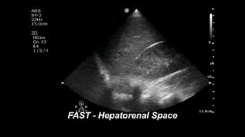 drjeffy foamed foamus GIF