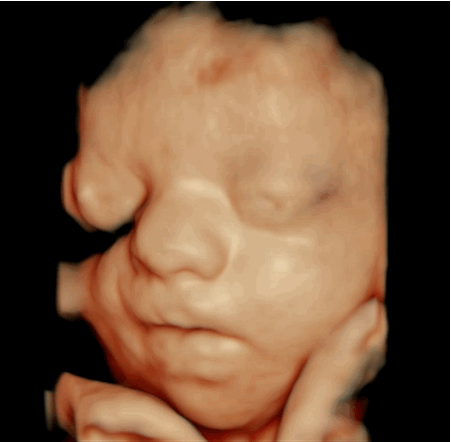 Fetus Perrie Tag Primogif
